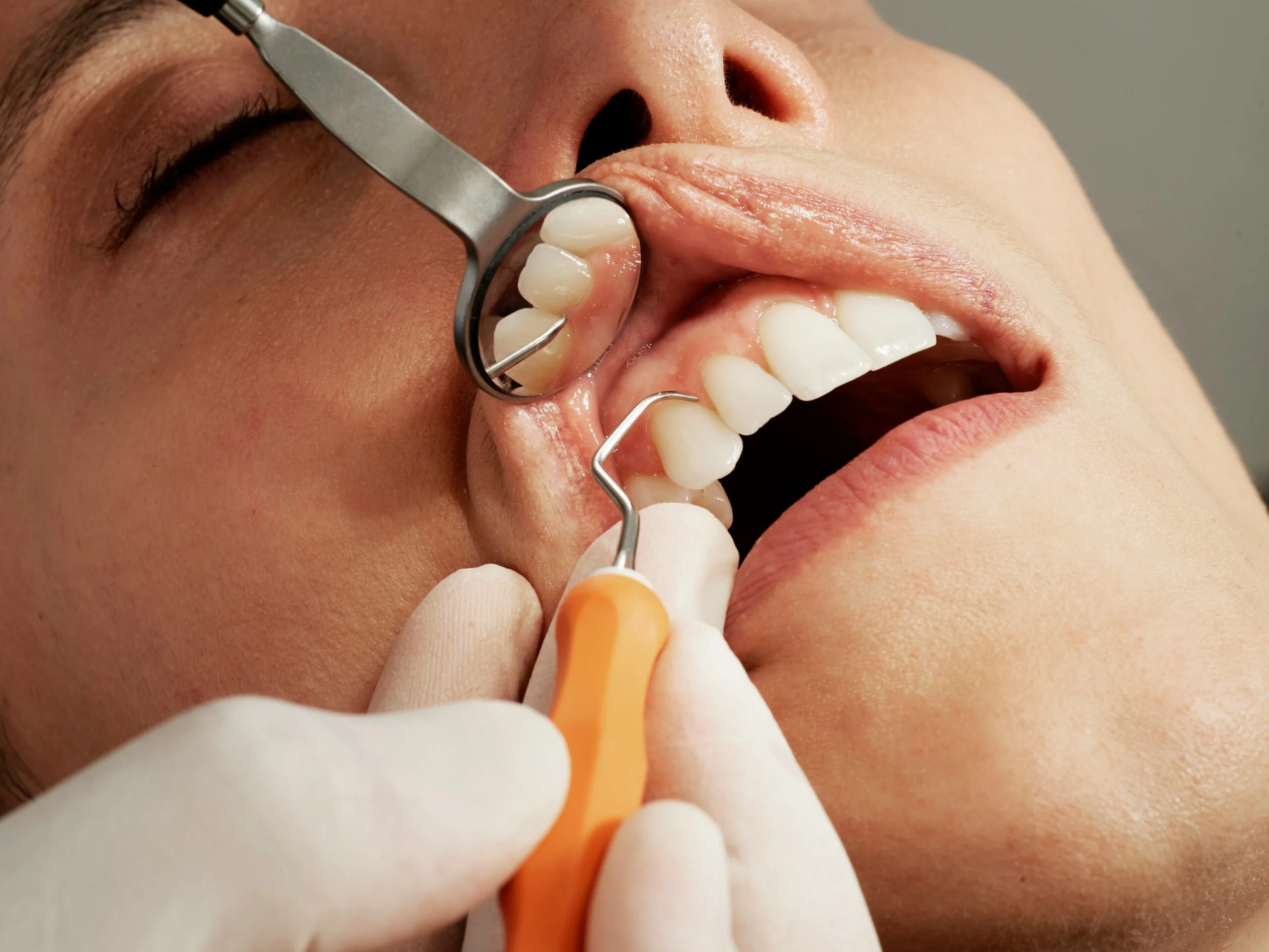 5 Reasons to Choose Turkey for Dental Treatment